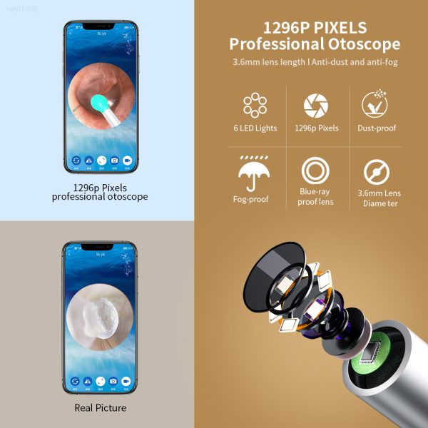 Smart Visual Ear Otoscope Endoscope Wax Removal Tool - Image 7